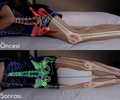 Pillowen Bacak Arası Yan Yatış Destek Yastığı
